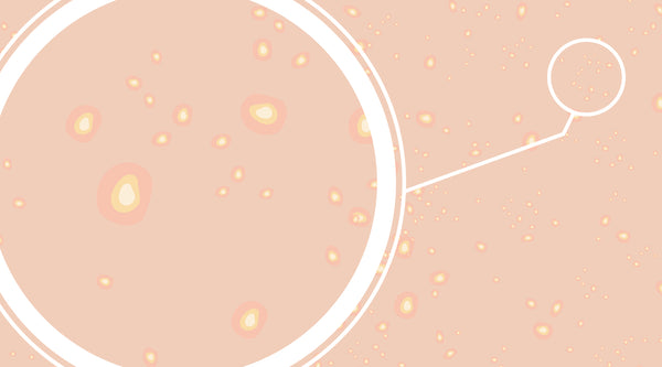 What is Skin Purging?